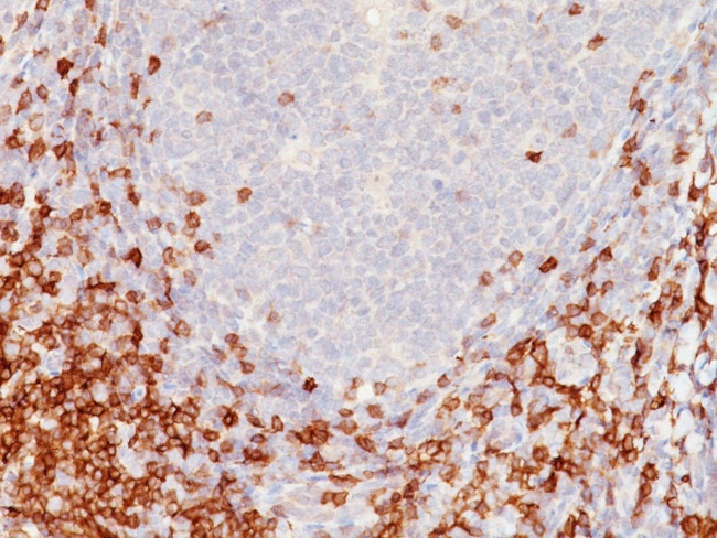 CD5 (Mantle Cell Lymphoma Marker) Antibody in Immunohistochemistry (Paraffin) (IHC (P))