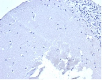 CD5 (Mantle Cell Lymphoma Marker) Antibody in Immunohistochemistry (Paraffin) (IHC (P))