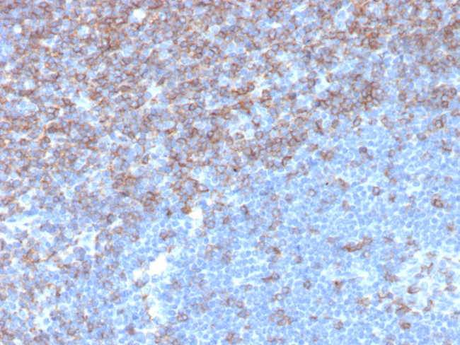 CD5 (Mantle Cell Lymphoma Marker) Antibody in Immunohistochemistry (Paraffin) (IHC (P))