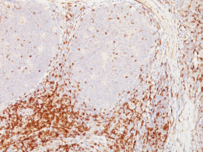 CD5 (Mantle Cell Lymphoma Marker) Antibody in Immunohistochemistry (Paraffin) (IHC (P))