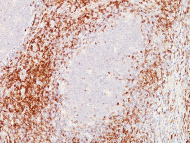CD5 (Mantle Cell Lymphoma Marker) Antibody in Immunohistochemistry (Paraffin) (IHC (P))