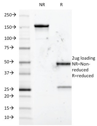 CD5 (Mantle Cell Lymphoma Marker) Antibody in SDS-PAGE (SDS-PAGE)