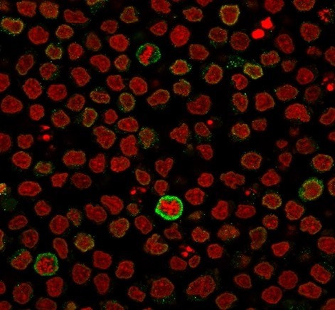 CD5 (Mantle Cell Lymphoma Marker) Antibody in Immunocytochemistry (ICC/IF)