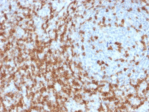 CD5 (Mantle Cell Lymphoma Marker) Antibody in Immunohistochemistry (Paraffin) (IHC (P))
