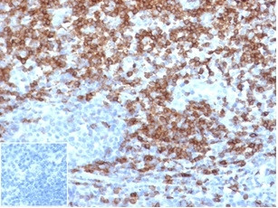 CD5 (Mantle Cell Lymphoma Marker) Antibody in Immunohistochemistry (Paraffin) (IHC (P))