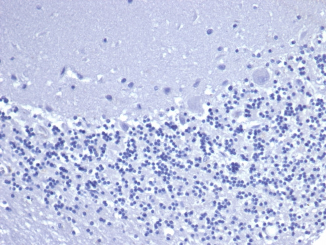 CD5 Antibody in Immunohistochemistry (Paraffin) (IHC (P))