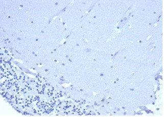 CD5 (Mantle Cell Lymphoma Marker) Antibody in Immunohistochemistry (Paraffin) (IHC (P))