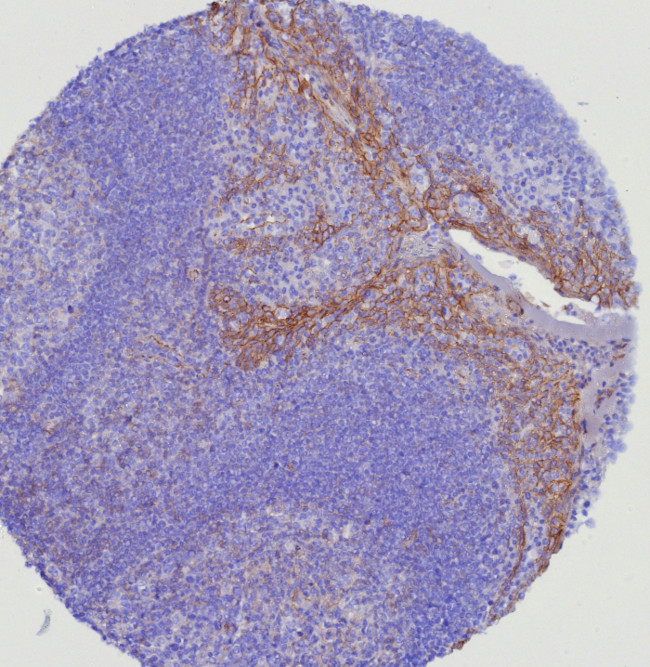 CD5 (Mantle Cell Lymphoma Marker) Antibody in Immunohistochemistry (Paraffin) (IHC (P))