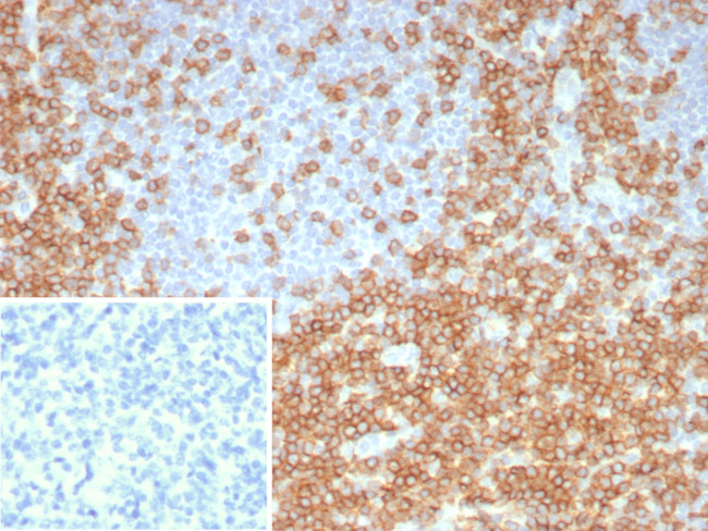 CD5 (Mantle Cell Lymphoma Marker) Antibody in Immunohistochemistry (Paraffin) (IHC (P))
