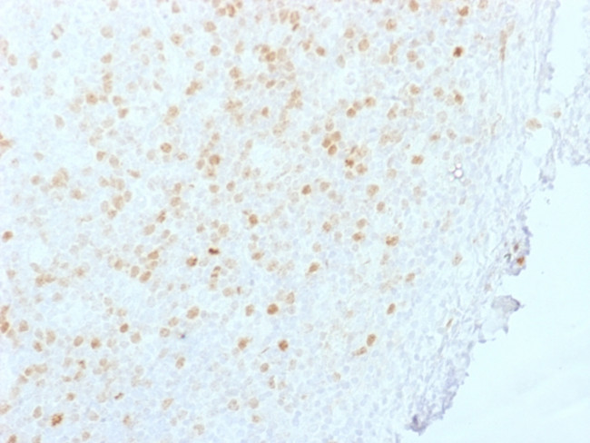 Aurora B (Proliferation Marker) Antibody in Immunohistochemistry (Paraffin) (IHC (P))
