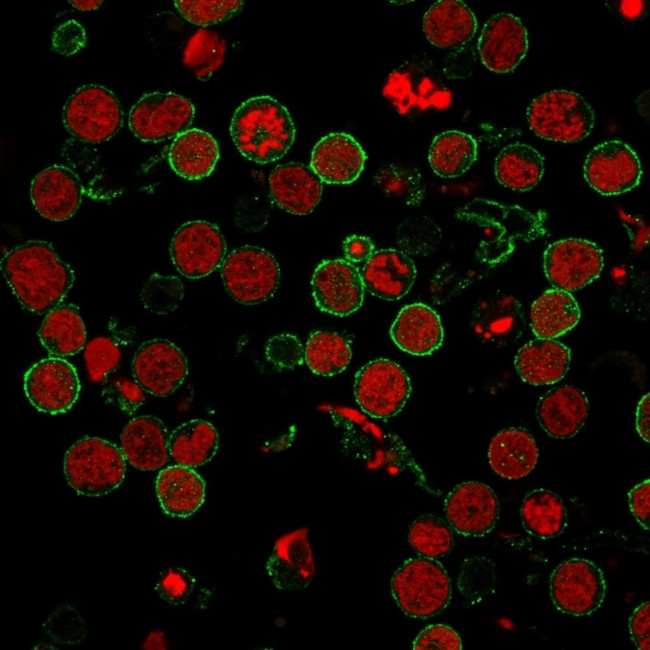CD6 (Negative Marker of T-regulatory Cells) Antibody in Immunocytochemistry (ICC/IF)