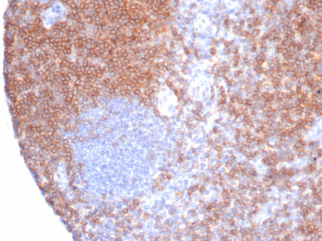 CD6 Antibody in Immunohistochemistry (Paraffin) (IHC (P))