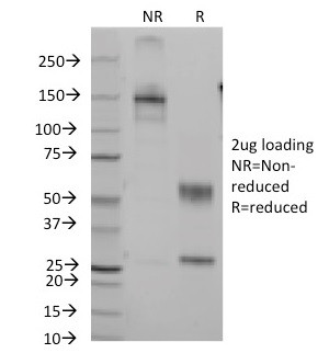 CD7 (T-Cell Leukemia Marker) Antibody in SDS-PAGE (SDS-PAGE)