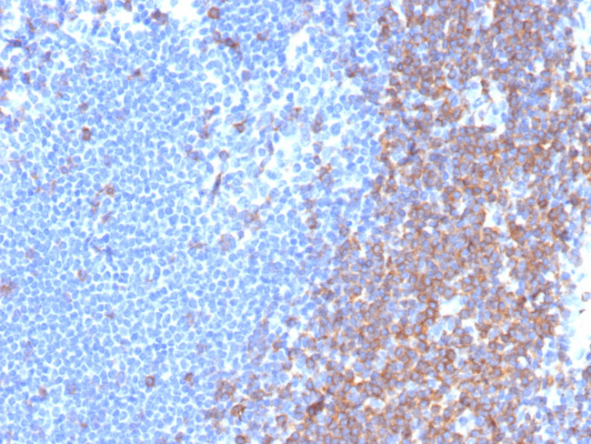 CD7 (T-Cell Leukemia Marker) Antibody in Immunohistochemistry (Paraffin) (IHC (P))