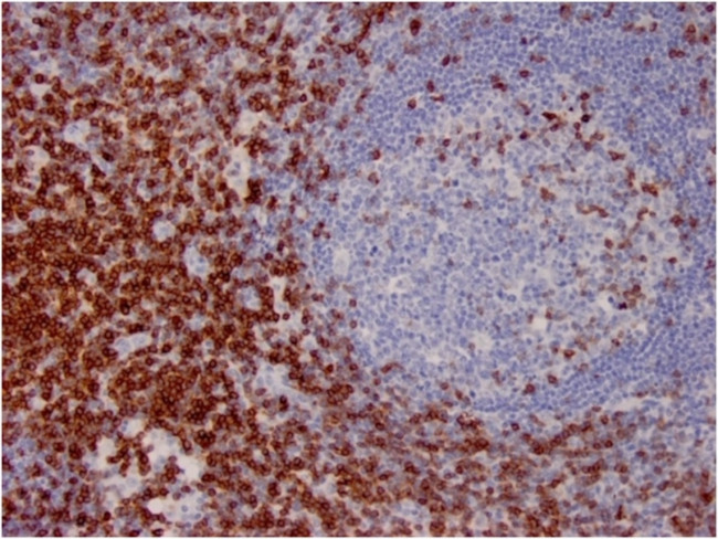 CD7 (T-Cell Leukemia Marker) Antibody in Immunohistochemistry (Paraffin) (IHC (P))