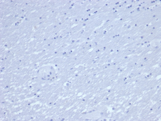 CD7 Antibody in Immunohistochemistry (Paraffin) (IHC (P))