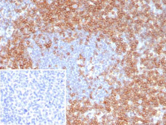 CD7 (T-Cell Leukemia Marker) Antibody in Immunohistochemistry (Paraffin) (IHC (P))