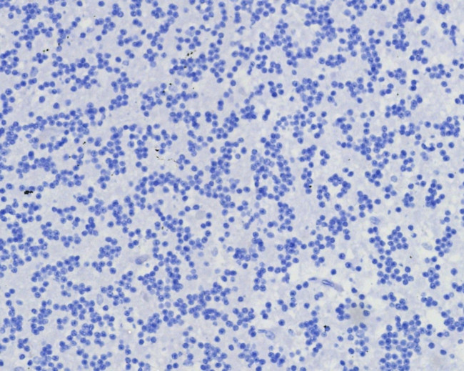 CD7 (T-Cell Leukemia Marker) Antibody in Immunohistochemistry (Paraffin) (IHC (P))