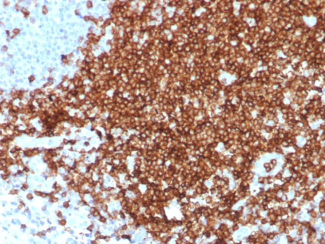 CD7 (T-Cell Leukemia Marker) Antibody in Immunohistochemistry (Paraffin) (IHC (P))