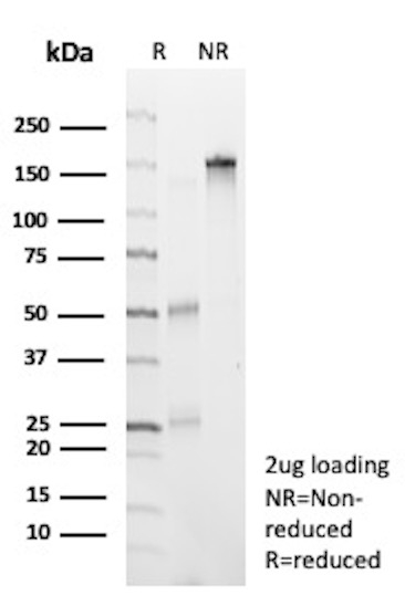 CD7 (T-Cell Leukemia Marker) Antibody in SDS-PAGE (SDS-PAGE)