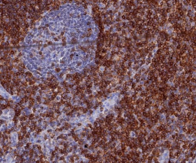 CD7 (T-Cell Leukemia Marker) Antibody in Immunohistochemistry (Paraffin) (IHC (P))