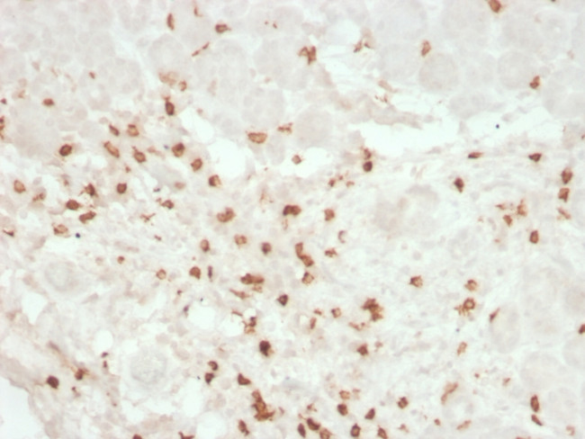 CD8A (Cytotoxic- and Suppressor T-Cell Marker) Monoclonal Antibody (rC8 ...