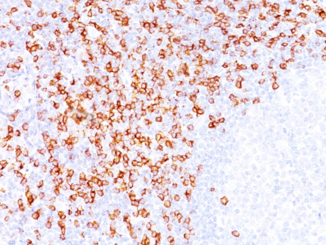 CD8A (Cytotoxic/Suppressor T-Cell Marker) Antibody in Immunohistochemistry (Paraffin) (IHC (P))