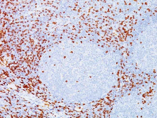 CD8A (Cytotoxic/Suppressor T-Cell Marker) Antibody in Immunohistochemistry (Paraffin) (IHC (P))