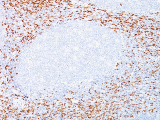 CD8A (Cytotoxic- and Suppressor T-Cell Marker) Antibody in Immunohistochemistry (Paraffin) (IHC (P))