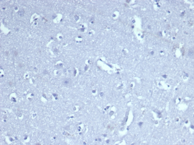 CD8A Antibody in Immunohistochemistry (Paraffin) (IHC (P))