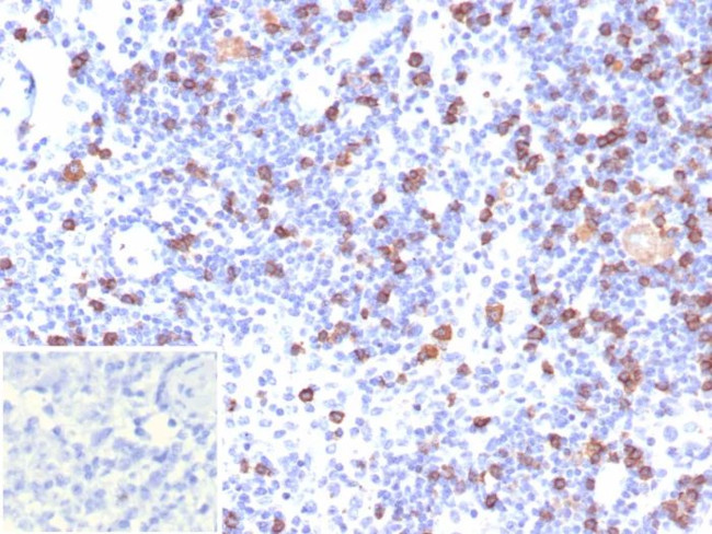 CD8A (Cytotoxic/Suppressor T-Cell Marker) Antibody in Immunohistochemistry (Paraffin) (IHC (P))