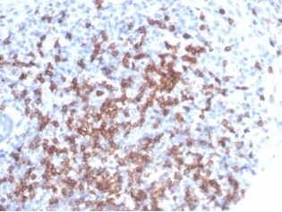 CD8A (Cytotoxic- and Suppressor T-Cell Marker) Antibody in Immunohistochemistry (Paraffin) (IHC (P))