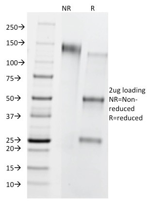 CD8B (Cytotoxic/Suppressor T-Cell Marker) Antibody in SDS-PAGE (SDS-PAGE)