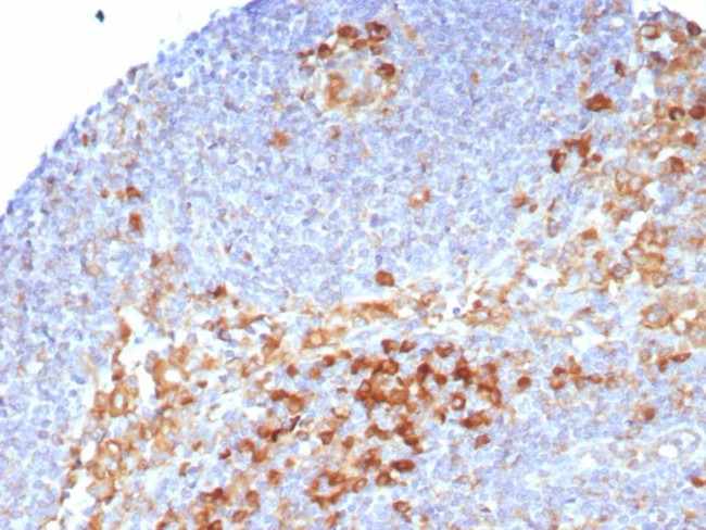 CD9 (TSPAN29) (Motility-Related Protein-1) Antibody in Immunohistochemistry (Paraffin) (IHC (P))