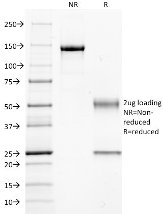 CD14 (Monocyte/Macrophage Marker) Antibody in SDS-PAGE (SDS-PAGE)