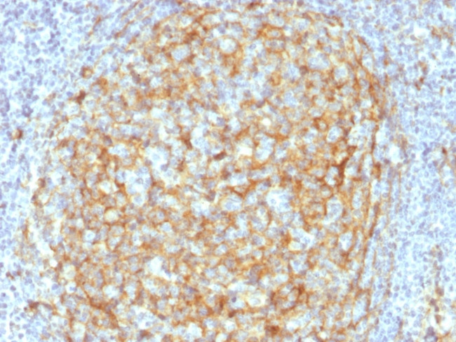 CD14 Antibody in Immunohistochemistry (Paraffin) (IHC (P))