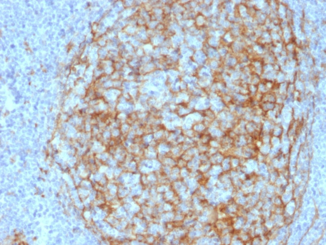CD14 Antibody in Immunohistochemistry (Paraffin) (IHC (P))