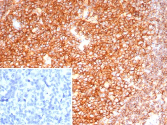 CD19 (B-Lymphocyte Marker) Antibody in Immunohistochemistry (Paraffin) (IHC (P))
