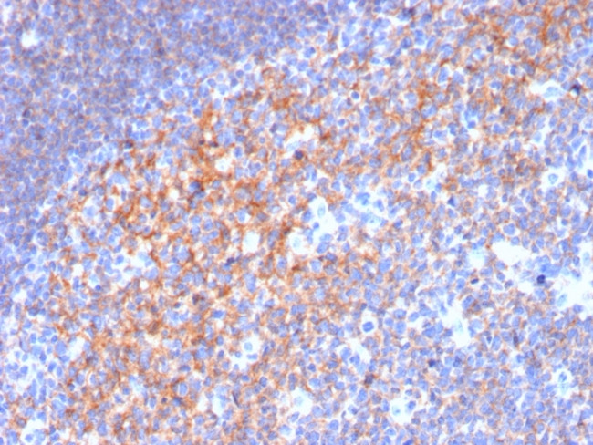 CD19 (B-Lymphocyte Marker) Antibody in Immunohistochemistry (Paraffin) (IHC (P))