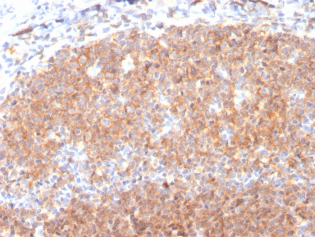 CD19 (B-Lymphocyte Marker) Antibody in Immunohistochemistry (Paraffin) (IHC (P))