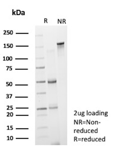 CD19 (B-Lymphocyte Marker) Antibody in SDS-PAGE (SDS-PAGE)