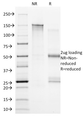 CD20/MS4A1 (B-Cell Marker) Antibody in SDS-PAGE (SDS-PAGE)