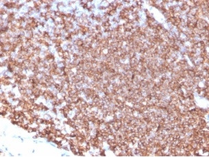 CD20/MS4A1 (B-Cell Marker) Antibody in Immunohistochemistry (Paraffin) (IHC (P))