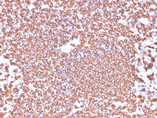 CD20/MS4A1 (B-Cell Marker) Antibody in Immunohistochemistry (Paraffin) (IHC (P))