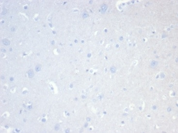 CD20/MS4A1 (B-Cell Marker) Antibody in Immunohistochemistry (Paraffin) (IHC (P))