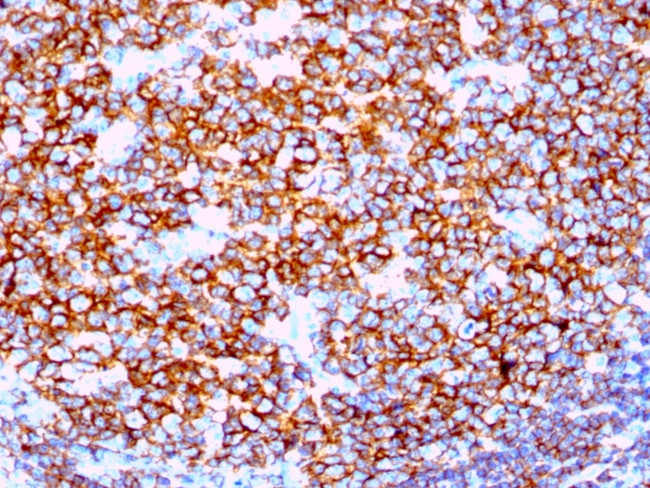 CD20/MS4A1 Antibody in Immunohistochemistry (Paraffin) (IHC (P))