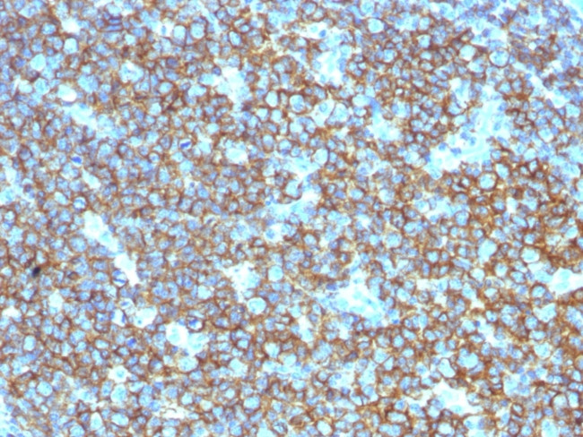 CD20/MS4A1 (B-Cell Marker) Antibody in Immunohistochemistry (Paraffin) (IHC (P))