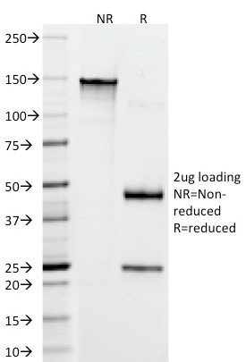 CD22/BL-CAM (B-Cell Marker) Antibody in SDS-PAGE (SDS-PAGE)
