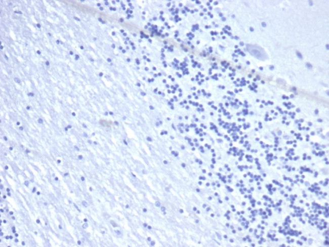 CD22/BL-CAM (B-Cell Marker) Antibody in Immunohistochemistry (Paraffin) (IHC (P))