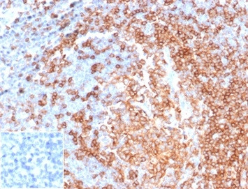 CD22/BL-CAM (B-Cell Marker) Antibody in Immunohistochemistry (Paraffin) (IHC (P))